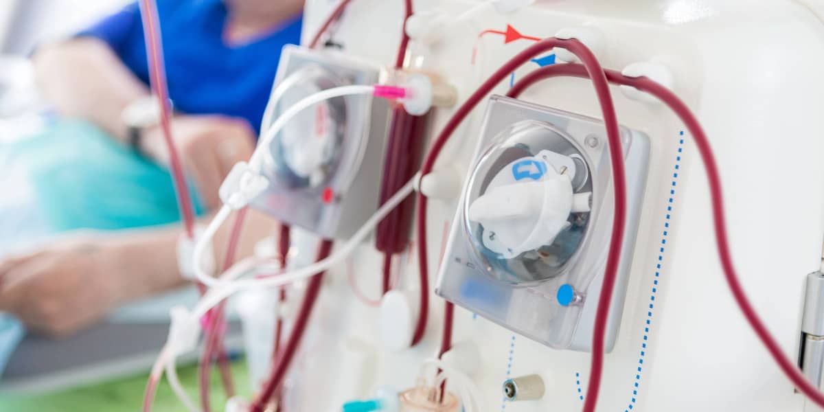 Close-up of a medical dialysis machine with blood tubes connected, and a patient in the background