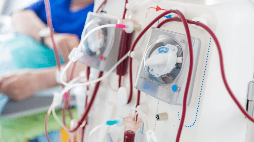 Close-up of a dialysis machine with tubes and blood in a medical setting