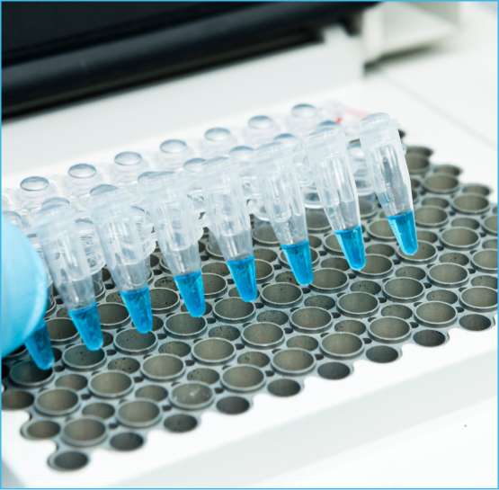 Gloved hand positioning a row of pipette tips with blue liquid above a white plastic rack with circular wells