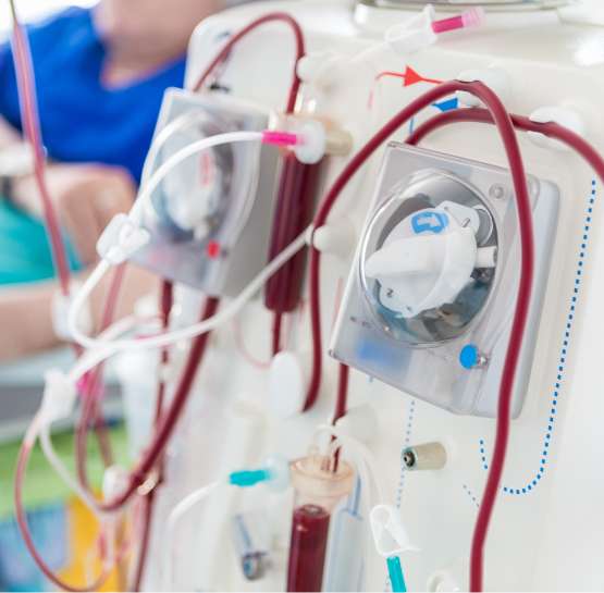 Close-up of dialysis equipment with tubes and a patient in the background