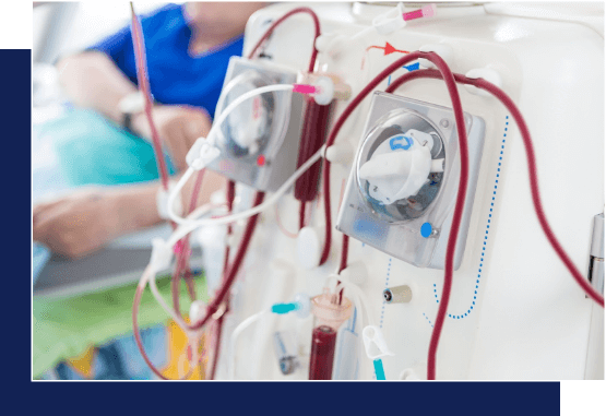 Close-up of dialysis equipment with tubes and a patient in the background