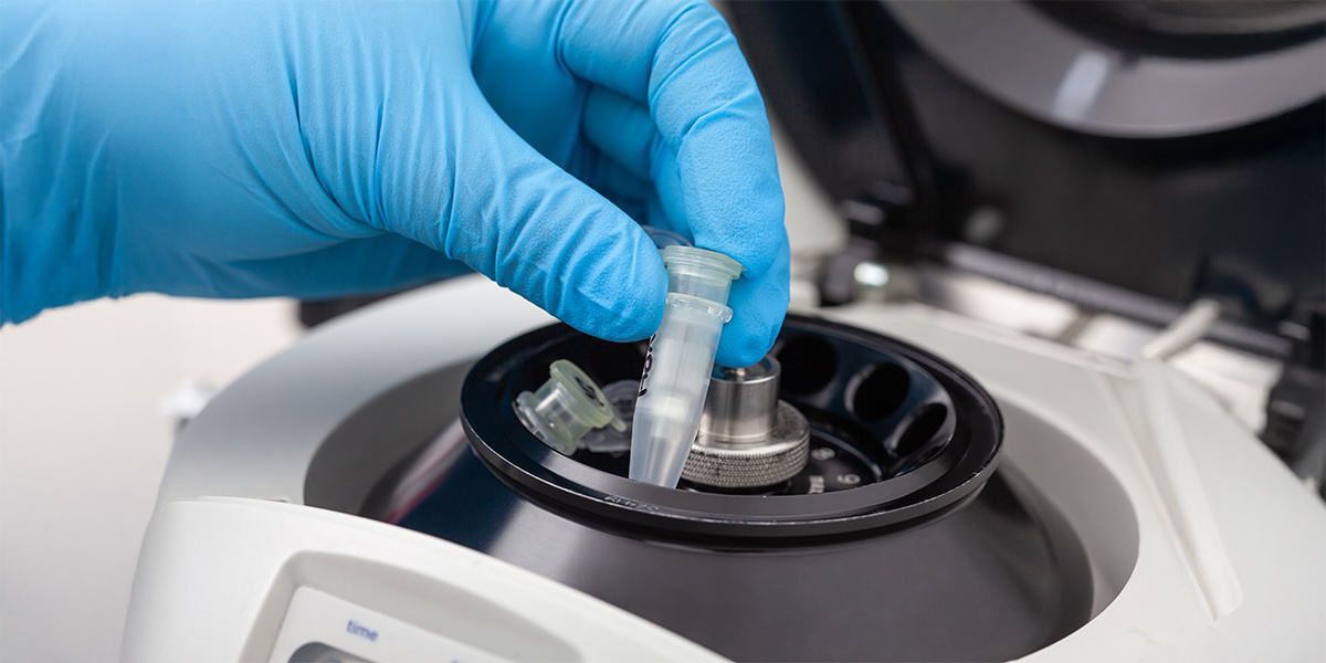 Selecting a Pump for Nucleic Acid Sample Preparation